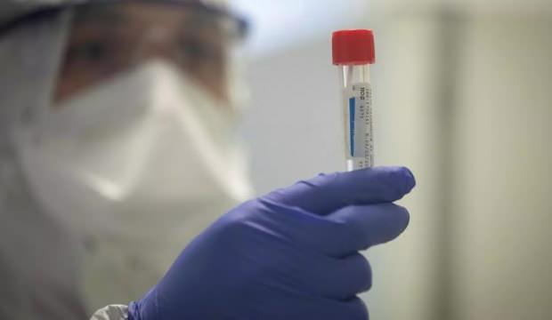 Koronavirüse karşı yeni ilaç umudu: Çalışmalar temmuz ayında başlıyor