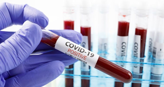 Üşüttüm diyene koronavirüs testi